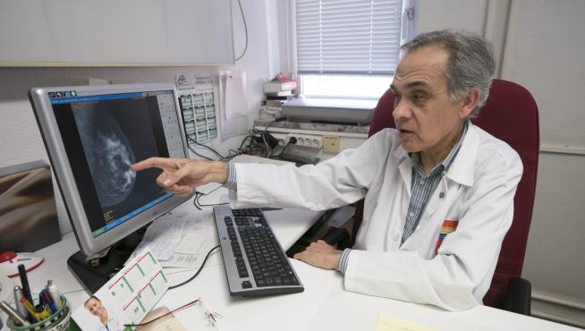 El jefe de Cirugía del hospital Obispo Polanco, José María del Val, muestra un estudio mamario.