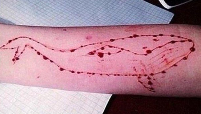Escarificación de una ballena en el brazo de una adolescente retada por el juego de la 'ballena azul'.