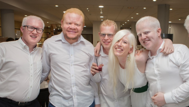 Imagen del primer encuentro nacional de jóvenes albinos, en 2016