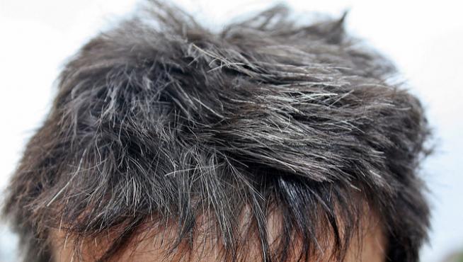 Los melanocitos del folículo piloso producen el pigmento que da color al cabello
