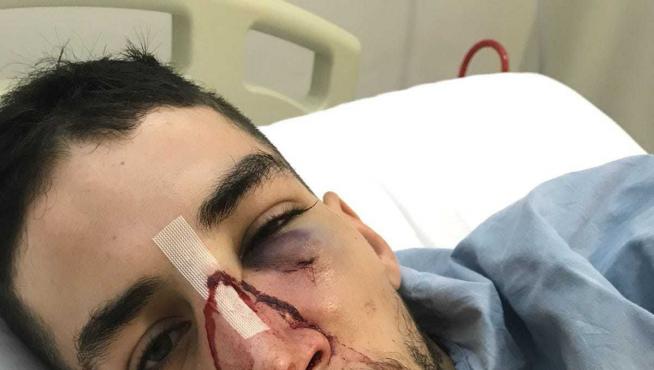El jugador agredido tuvo que ser operado en un hospital de fractura facial y maxilar.