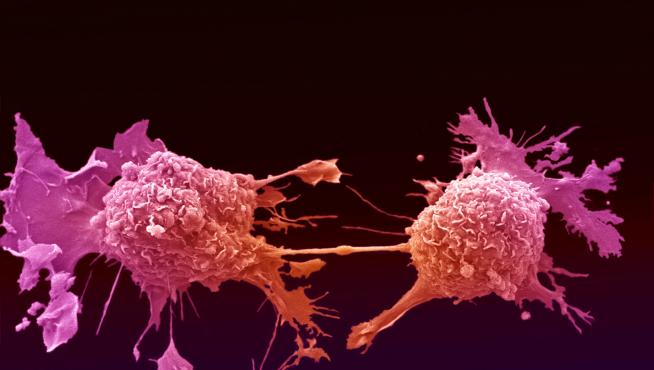 Células de cáncer de pulmón dividiéndose, unidas por un delgado hilo de citoplasma