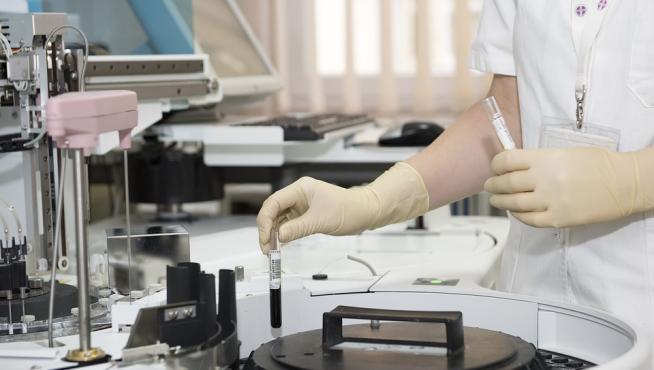 Ha sufrido una meningitis por listeria monocytogenes