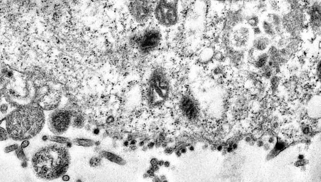 Así infecta el coronavirus a una célula
