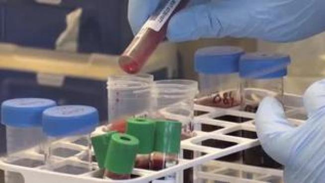 La europea de Oxford y Astrazeneca coge impulso y es efectiva también en las personas más mayores