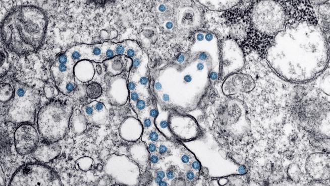 Partículas del virus SARS-CoV-2, coloreadas en azul, vistas al microscopio de electrones.