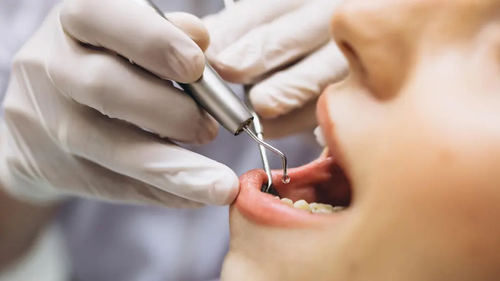 El 47 por ciento de los españoles tiene un poco, bastante o mucho miedo a acudir al dentista.