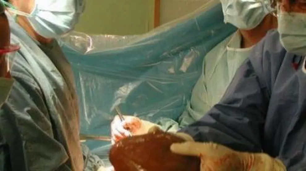 Trasplante hepático realizado en el Hospital Clínico de Zaragoza.