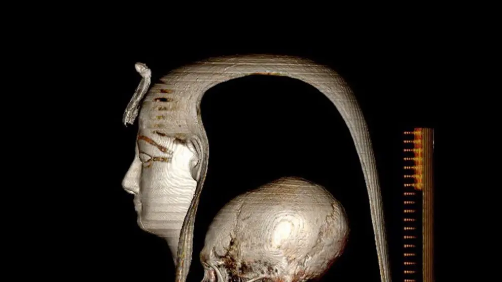 Los investigadores de la Universidad de El Cairo publica en 'Frontiers in Medicine' el resultado de su investigación sobre la momia de Amenhotep EGYPT MONUMENTS RESEARCH