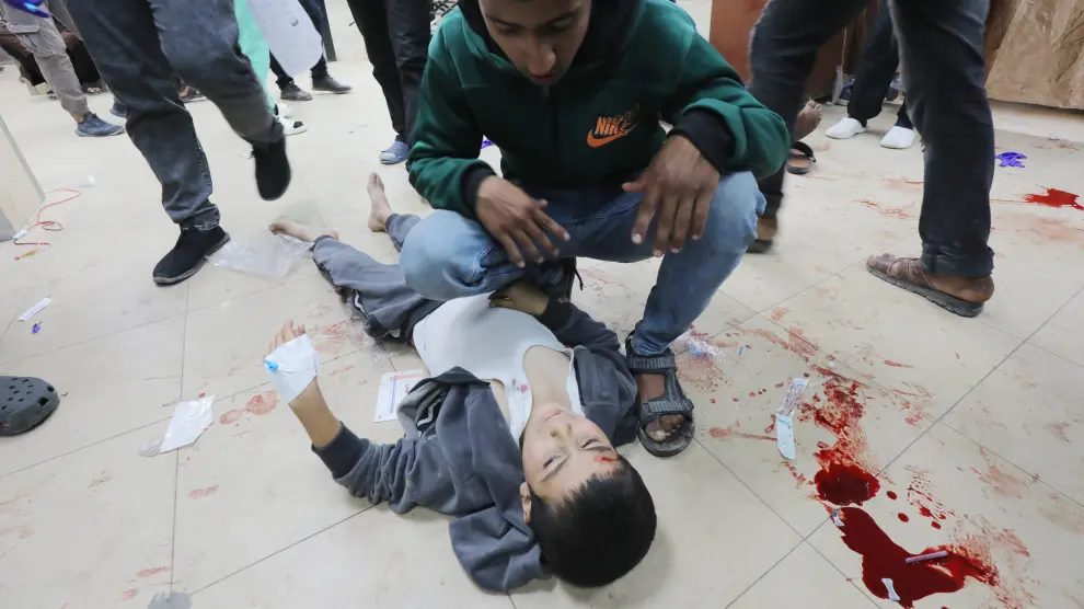 Un niño palestino herido tras un ataque de Israel, este domingo en Gaza.