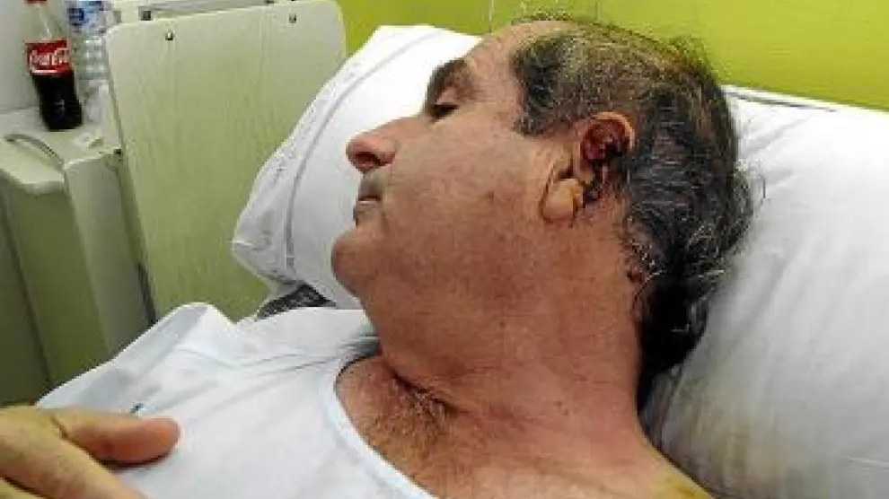 Ramón Rubira, atacado por una jauría el 17 de enero de 2010
