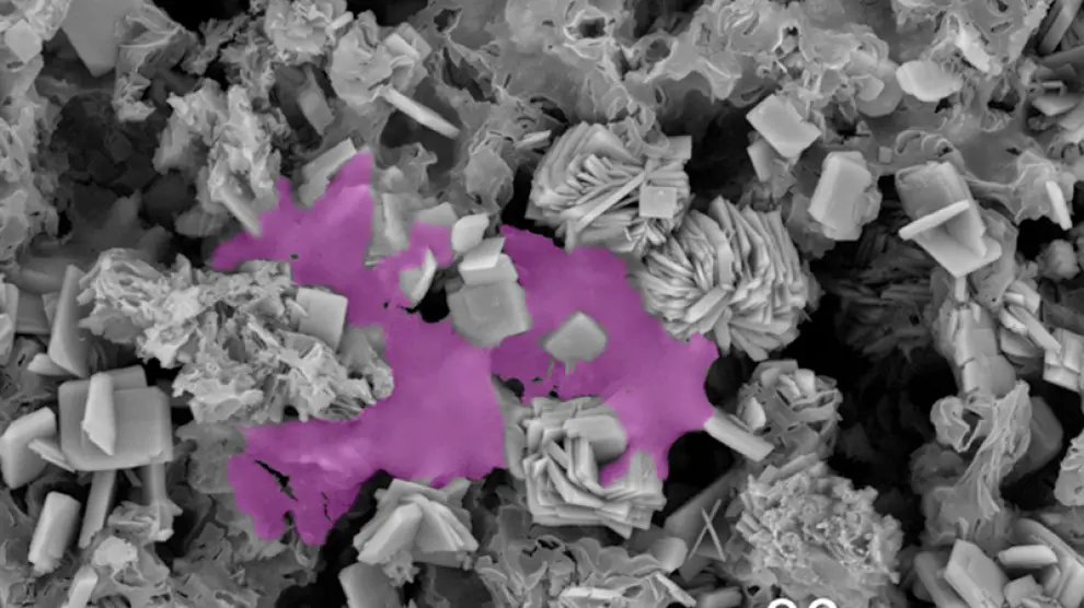 Célula osteoblástica humana colonizando el nuevo biomaterial (en púrpura), tras 72 horas de cultivo in vitro
