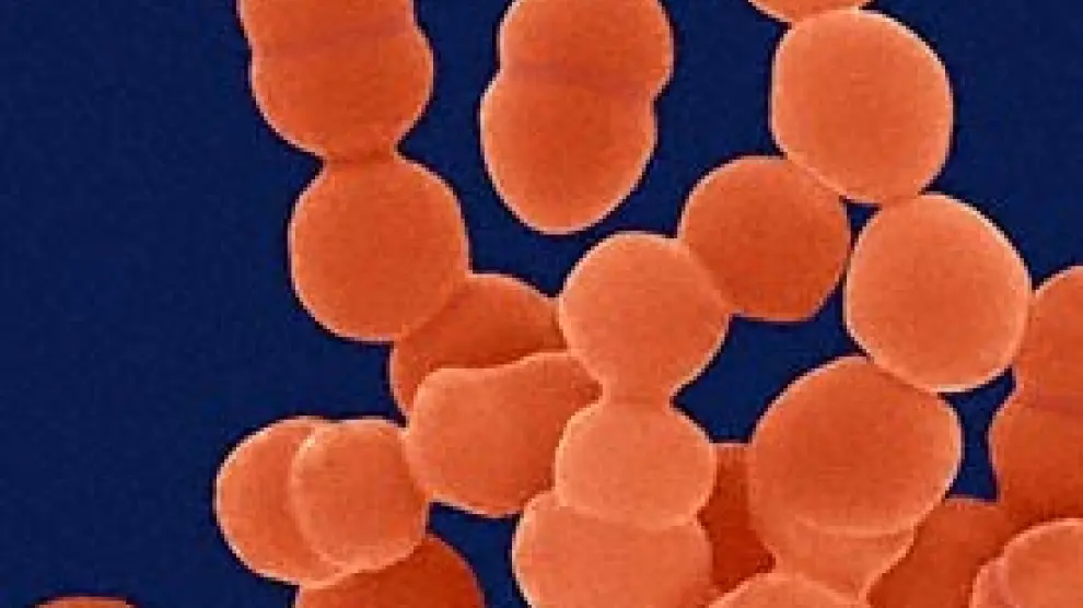 Staphilococcus epidermidis, una bacteria generalmente inofensiva que se encuentra en casi todas las zonas de nuestra piel