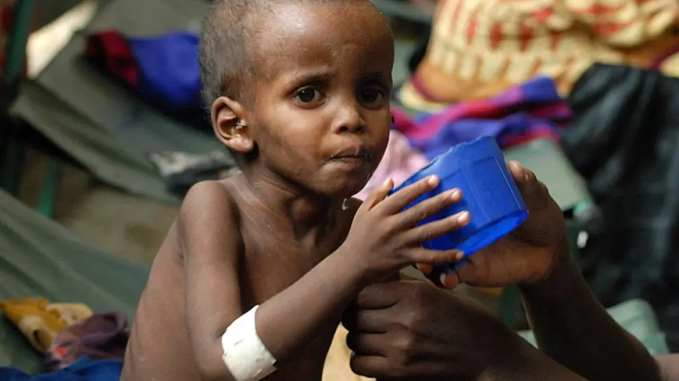 Un niño es atendido por sus problemas de salud en Somalia