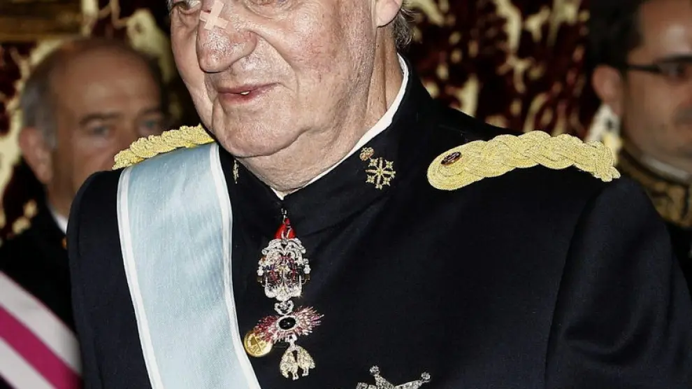 El Rey Juan Carlos con un hematoma en el ojo