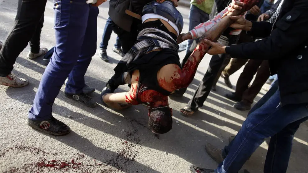 Uno de los heridos en El Cairo es trasladado