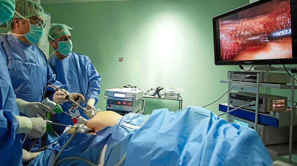 Uno de los instantes de la intervención por laparoscopia con tecnología 3D