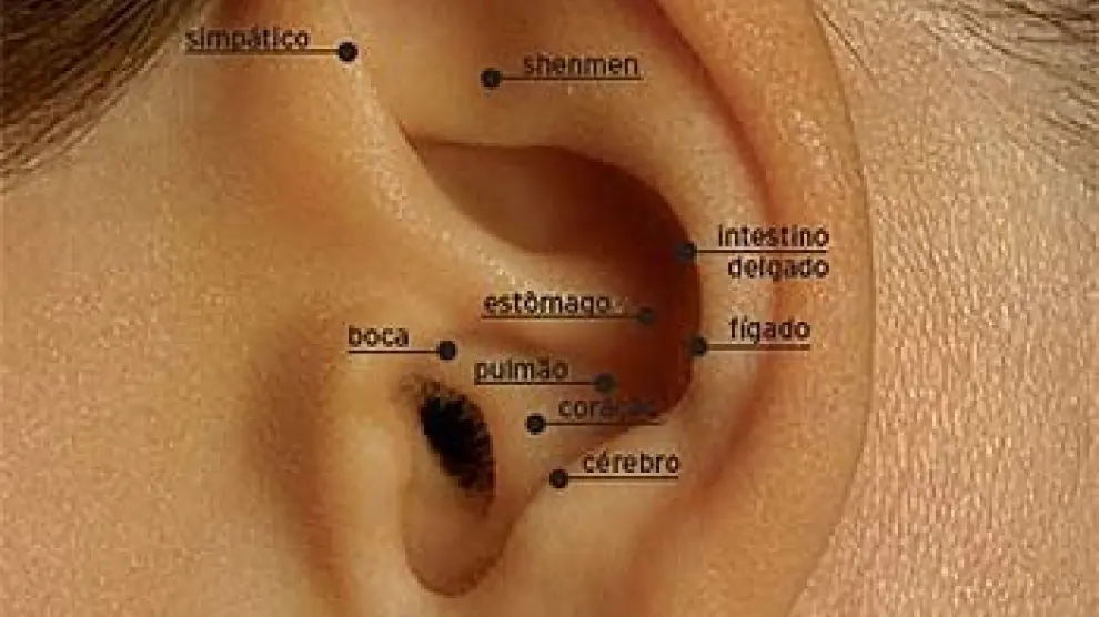 La auriculoterapia es una técnica terapéutica en la que se trata la superficie externa de la oreja o aurícula.