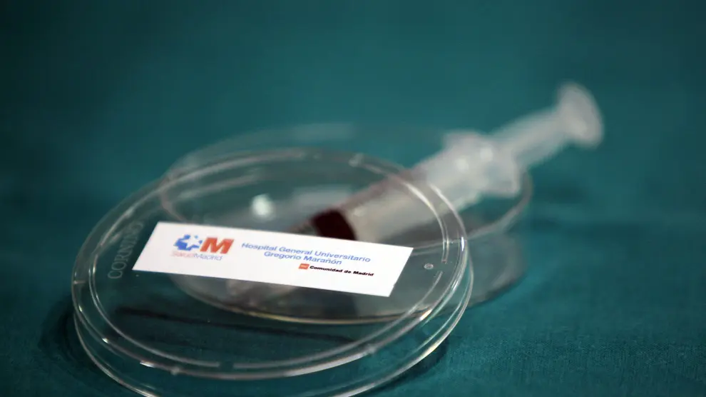 El gel microbicida podría prevenir la transmisión sexual del VIH