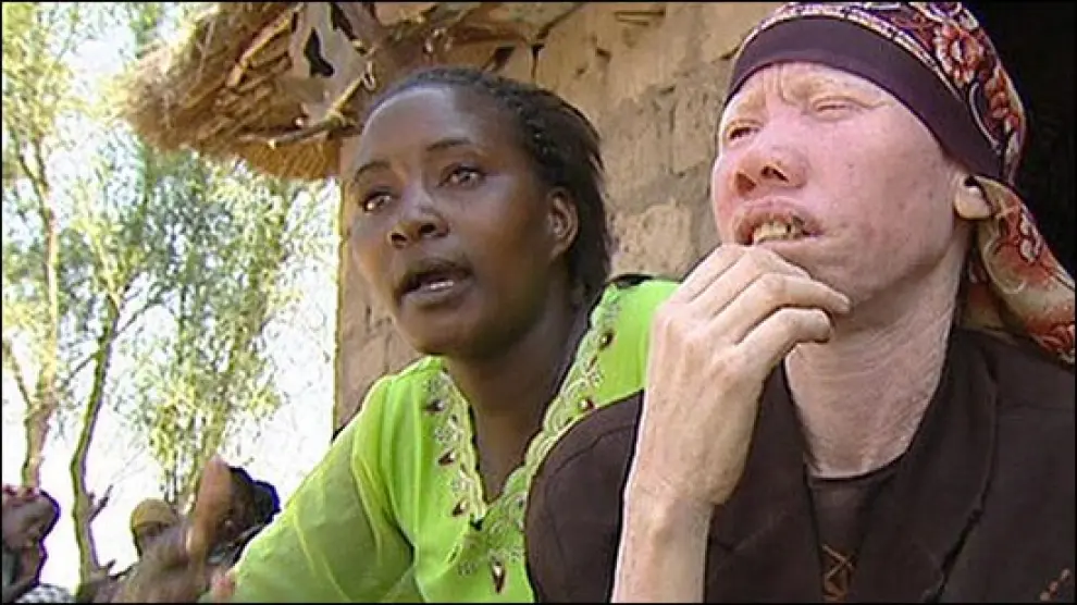 Detienen en Tanzania a 225 curanderos por matar a albinos para hacer rituales de brujería