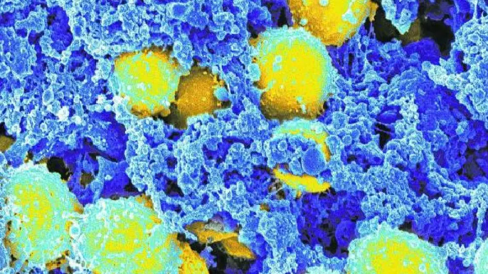 Una forma de la bacteria Staphylococcus aureus (coloreada en amarillo) se muestra resistente a la meticilina.