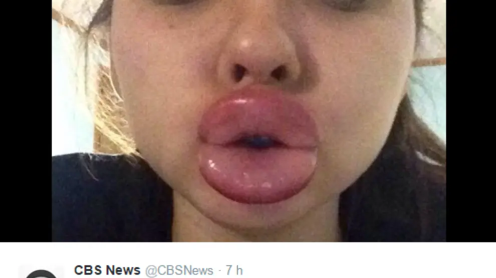 Una chica después de realizar el peligroso truco de los labios