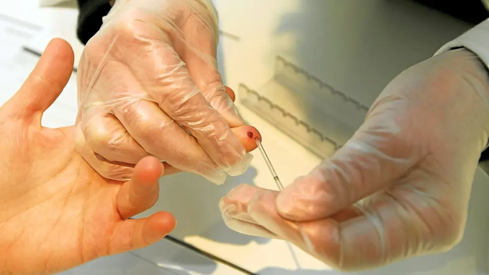 El test rápido de VIH se desarrolla en 20 minutos con una gota de sangre.