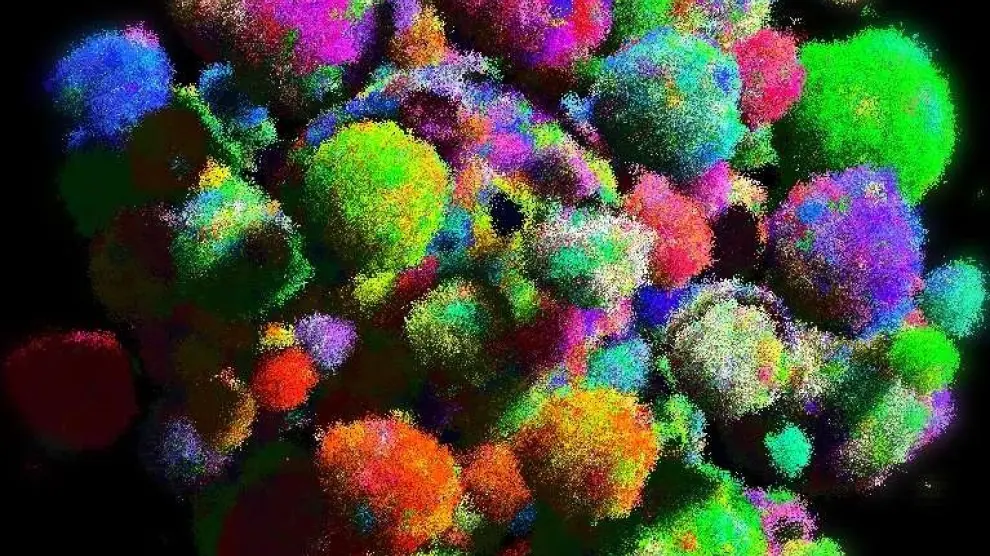 Un modelo tridimensional de un tumor que muestra los tipos de células en diferentes colores.