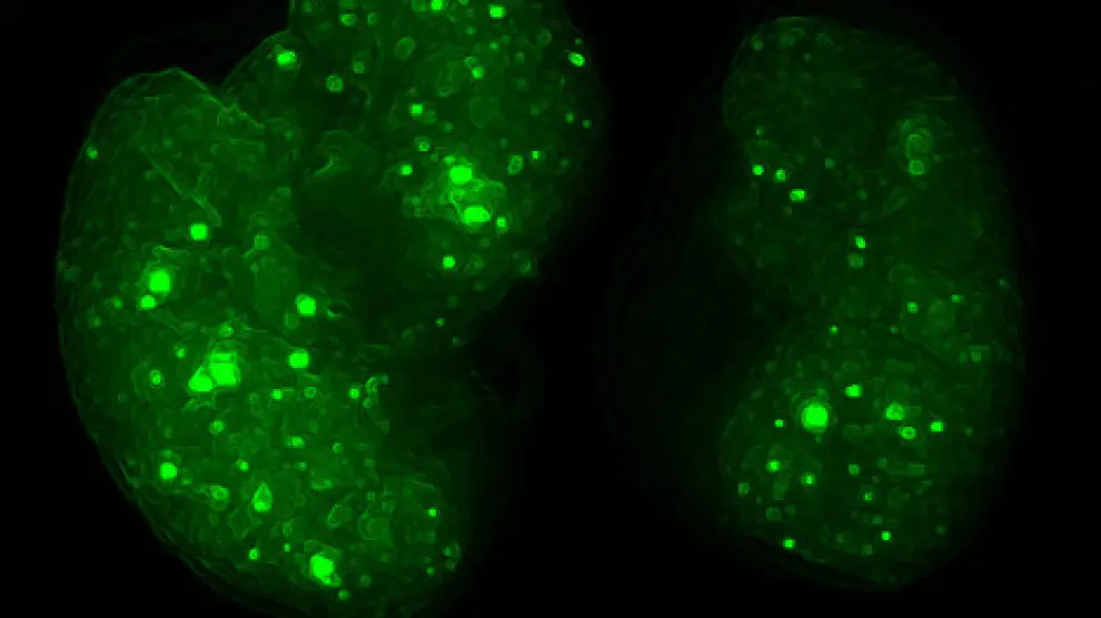 Reconstrucción digital de la distribución de exosomas tumorales (en verde) en pulmones de ratón durante la formación del nicho premetastásico.