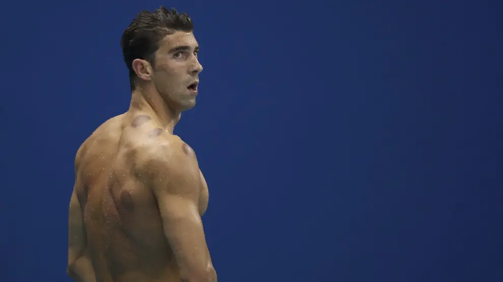 En esta imagen, tomada en la competición del domingo, son apreciables las marcas circulares de Michael Phelps.