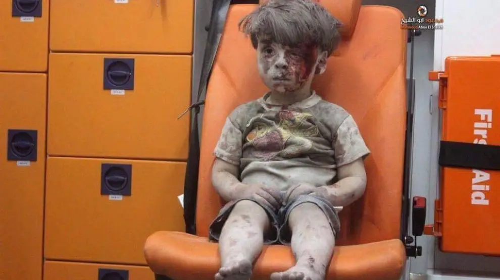 Omran, un niño herido en un bombardeo en Alepo, que ha puesto de nuevo rostro al drama en Siria.