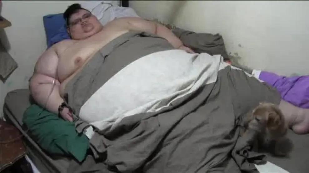 Este es el hombre más obeso del mundo