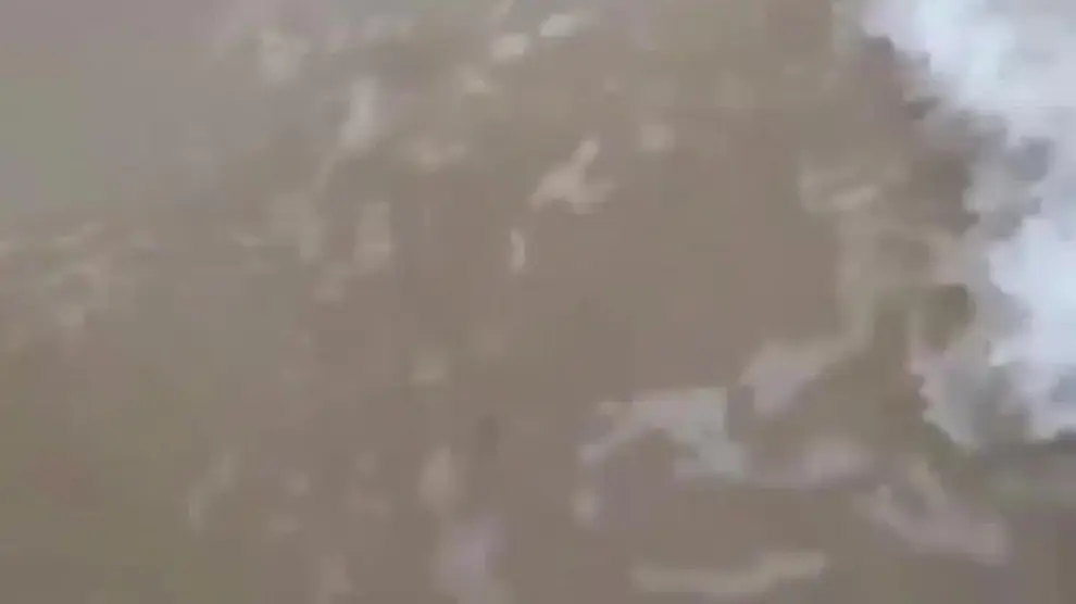 Un tiburón limón muerde a una turista