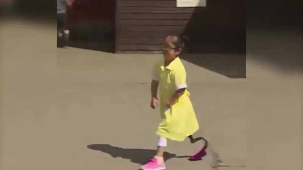 Una niña regresa al colegio tras implantarle una pierna