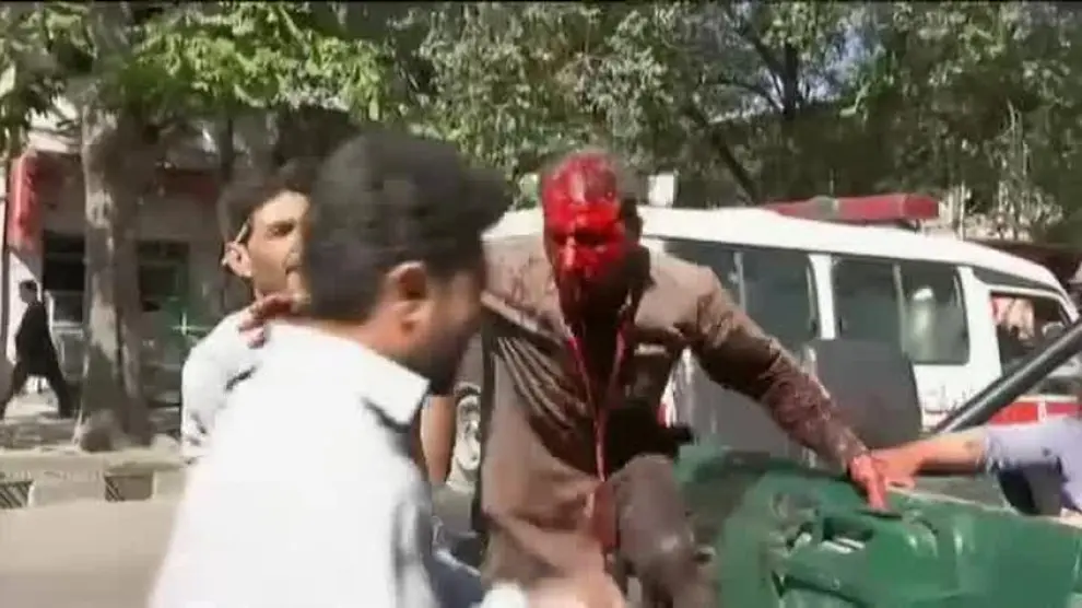 Un herido en el atentado de Kabul.