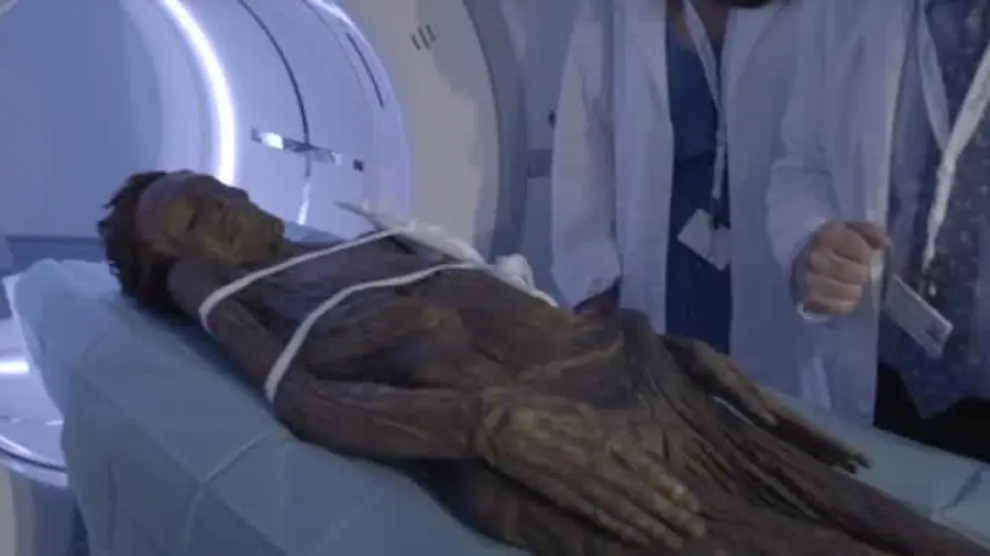 Los secretos de las cuatro momias del Museo Arqueológico Nacional al descubierto