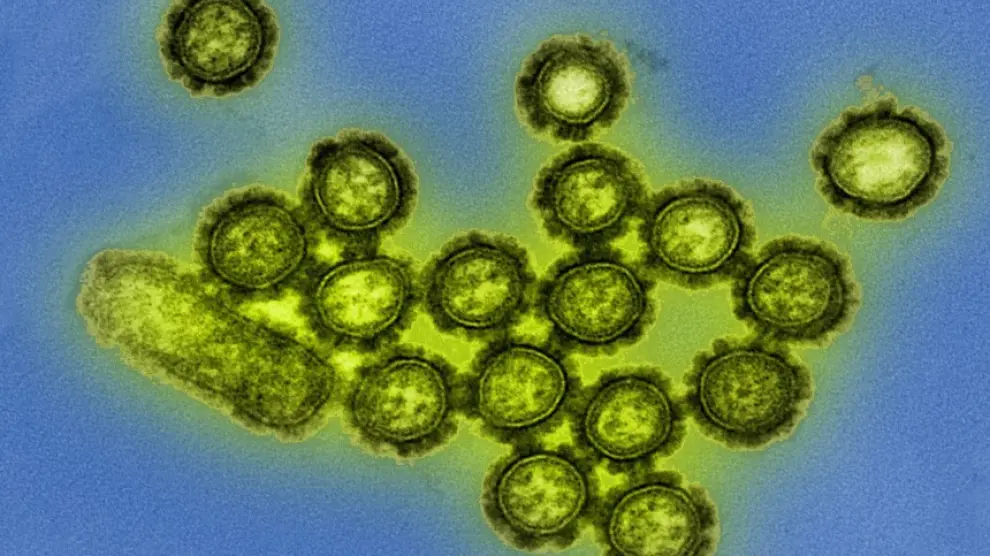 Micrografía electrónica coloreada que muestra partículas del virus de la gripe H1N1. Las proteínas superficiales del mismo están destacadas en negro