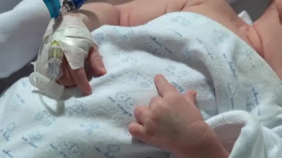 Carla, la primera bebé que recibe un corazón de grupo sanguíneo incompatible