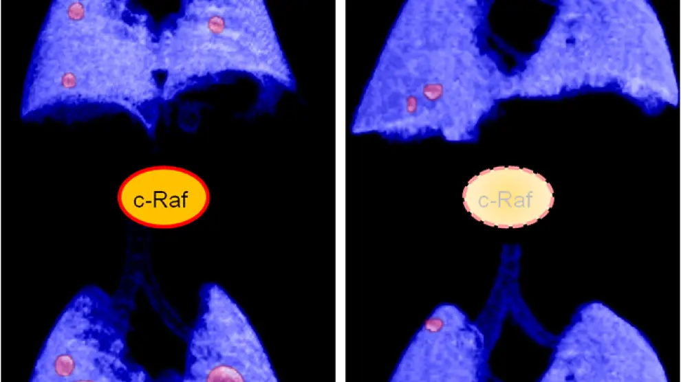 La eliminación de c-Raf induce la regresión de los tumores de pulmón avanzados en modelos de ratón.