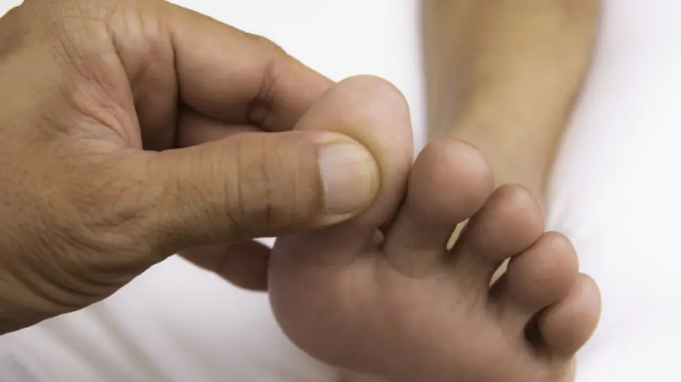 Un zapato demasiado prieto que comprima los dedos del pie, arrancar las uñas en lugar de cortarlas o que se tenga alguna deformidad en la zona puede favorecer la aparición de esta afección.