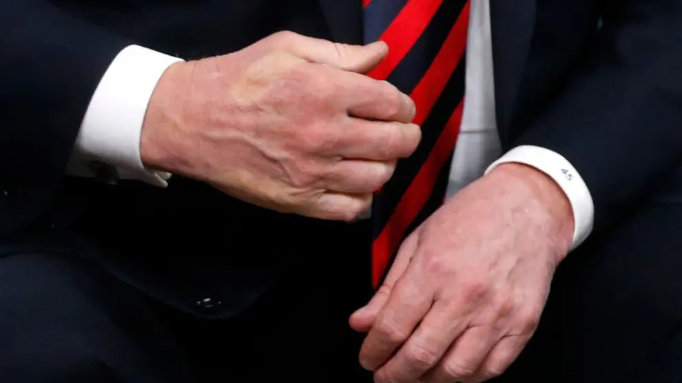 Macrón dejó sus dedos marcados en la mano de Trump.