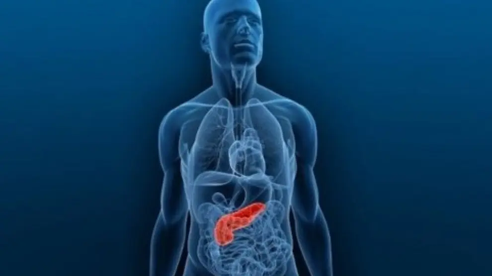 Sanidad alerta de la aparición de casos de pancreatitis aguda asociada al uso de dos fármacos