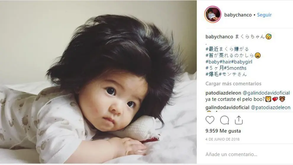 Baby Chanco acumula más de 300.000 seguidores en Instagram.