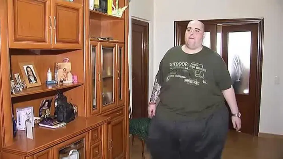 Teo, el joven con obesidad, se prepara para una operación tras perder más de 100 kilos