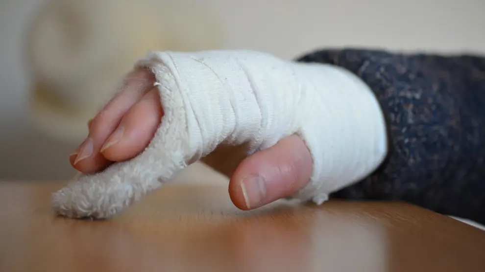 Las fracturas en alguna extremidad del cuerpo como la mano, suelen ser las más frecuentes.