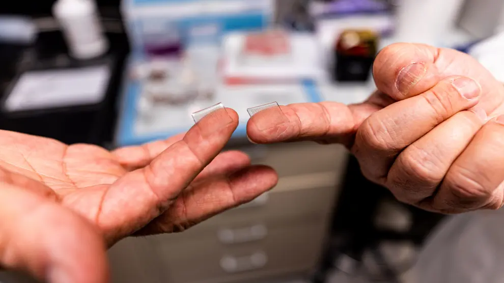 Fingertip-sized patches with dissolvable microscopic needles, a potential COVID-19 vaccine, are seen at the University of Pittsburgh, Pittsburgh, Pennsylvania, U.S., March 28, 2020. UPMC/Handout via REUTERS ATTENTION EDITORS - THIS IMAGE WAS PROVIDED BY A THIRD PARTY. MANDATORY CREDIT. NO RESALES. NO ARCHIVES [[[REUTERS VOCENTO]]] HEALTH-CORONAVIRUS/VACCINE-CANDIDATE