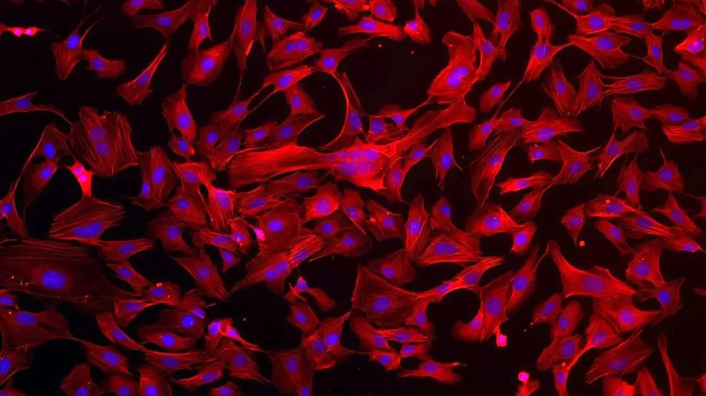 Componentes de células endoteliales humanas teñidas para su identificación. El endotelio, un tejido que recubre las paredes e los vasos sanguíneos, es un protagonista de la evolución de la covid-19.