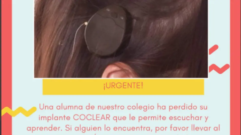 Buscan el implante coclear de una alumna del colegio La Purísima perdido por la zona de Corona de Aragón de Zaragoza
