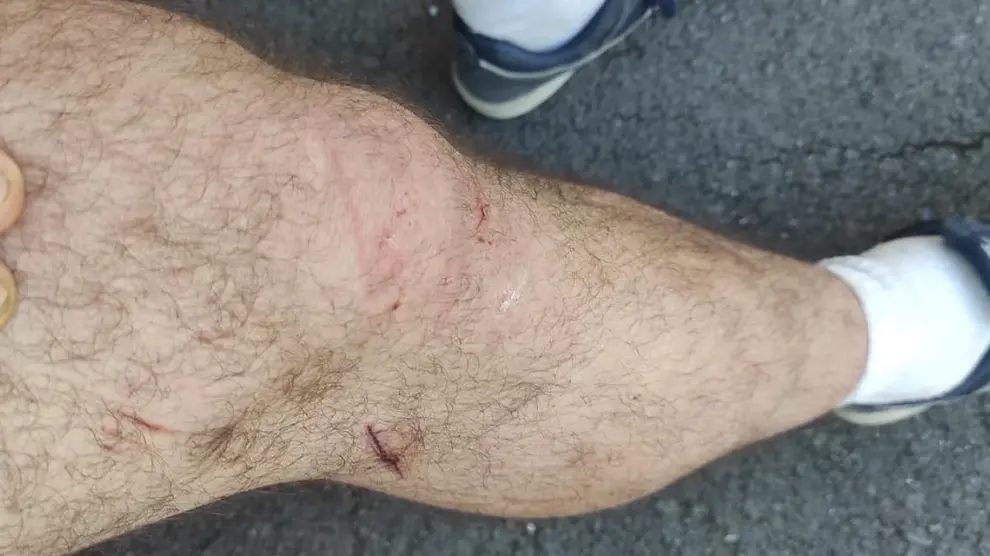 Carlos Yubero muestra algunas de las heridas que se hizo en la pierna cuando buscaba a la mujer en el pantano.