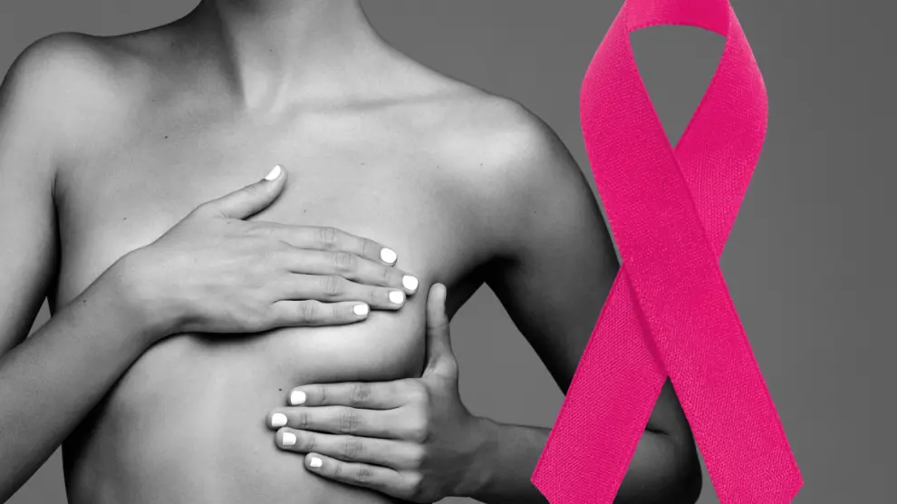 imagen de recurso del cáncer de mama